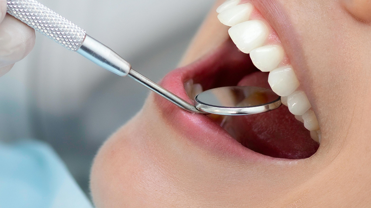 Loose, Cracked, or Painful? Understanding Dental Implant Crown Problems