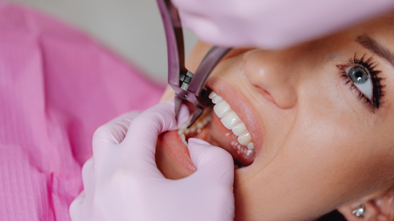 Front Tooth Dental Crown Procedure: Timeline, Pain, and Recovery