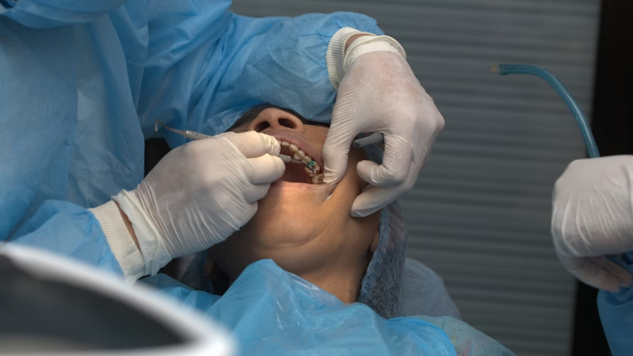 Top Foods to Avoid After a Tooth Extraction and Why They Slow Healing